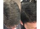 Sereni capelli te scapa de firele albe nedorite acasa simplu si rapid